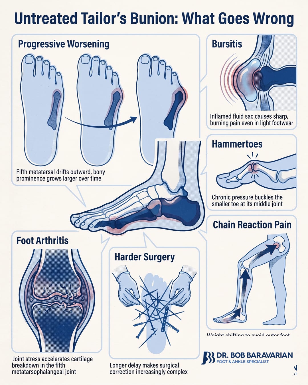 Tailor's Bunion: Causes, Symptoms & Treatment — infographic