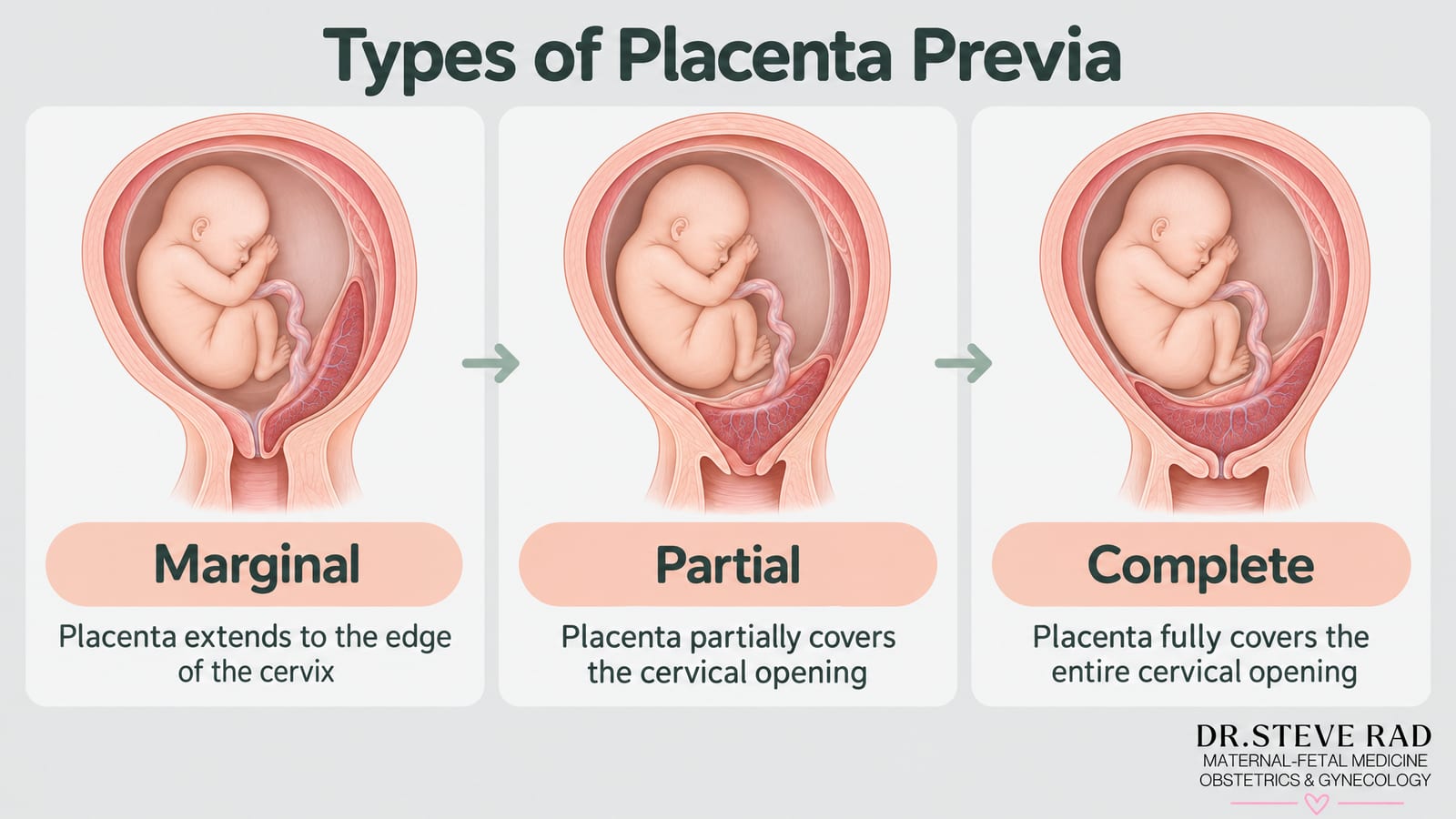 Rare Placenta Problems: A Complete Guide | Dr. Rad — infographic