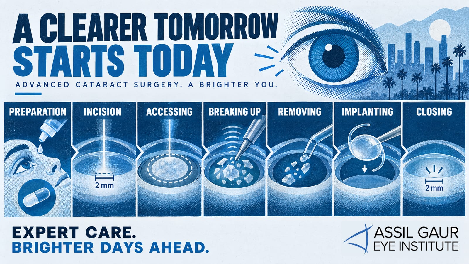 Best Cataract Surgery Los Angeles | Top Cataract Surgeons | Assil Gaur Eye Institute — infographic