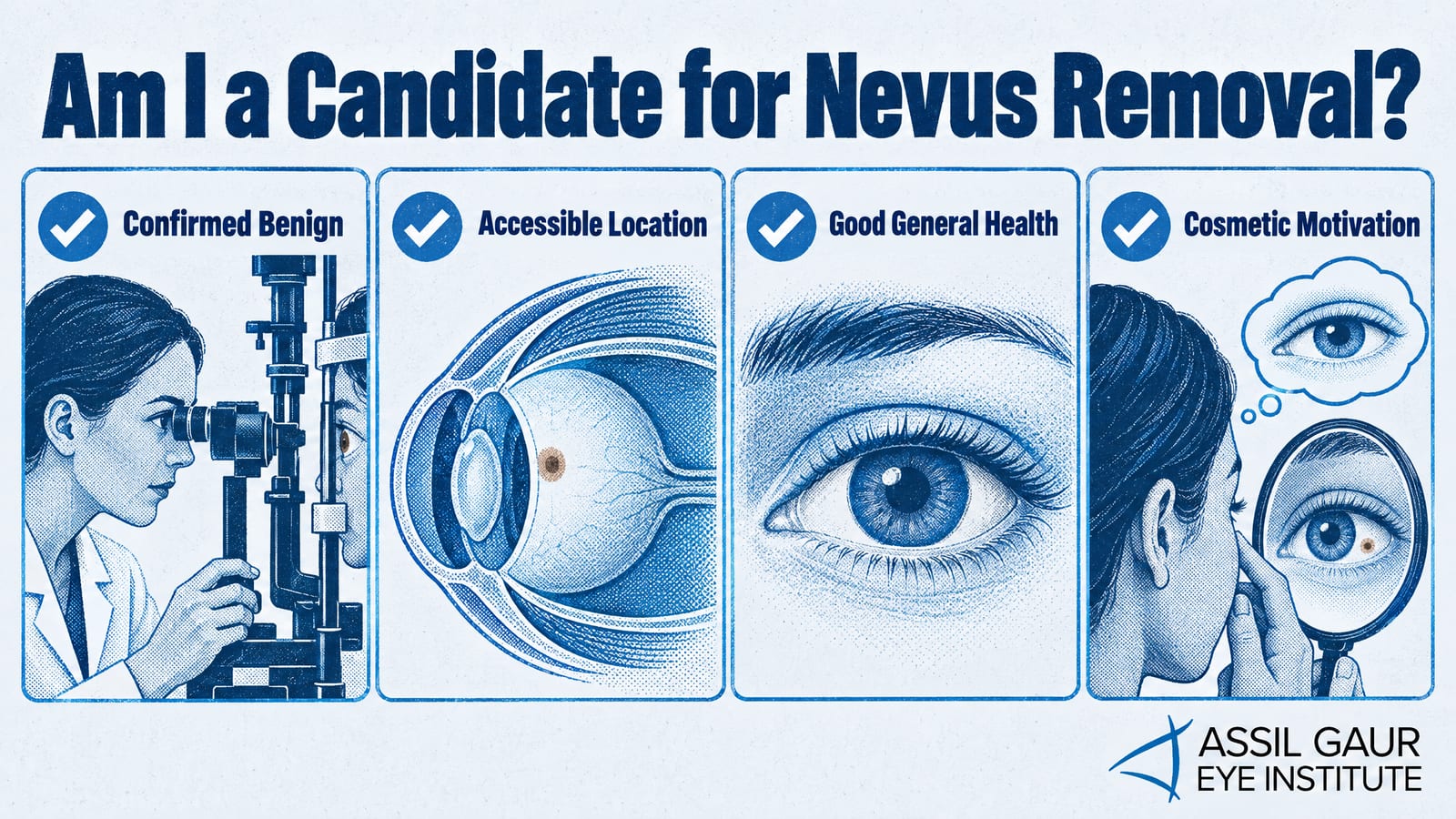 Conjunctival Nevus Removal | AGEI Los Angeles — infographic